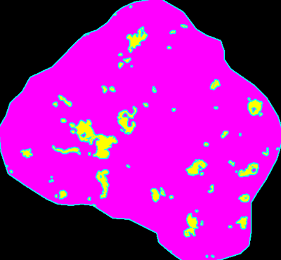 CD68（巨噬细胞）面积：998 μm2