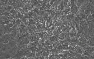 通过直接重新编程制造心肌诱导心肌样细胞（iCM细胞：induced cardiomyocytes）