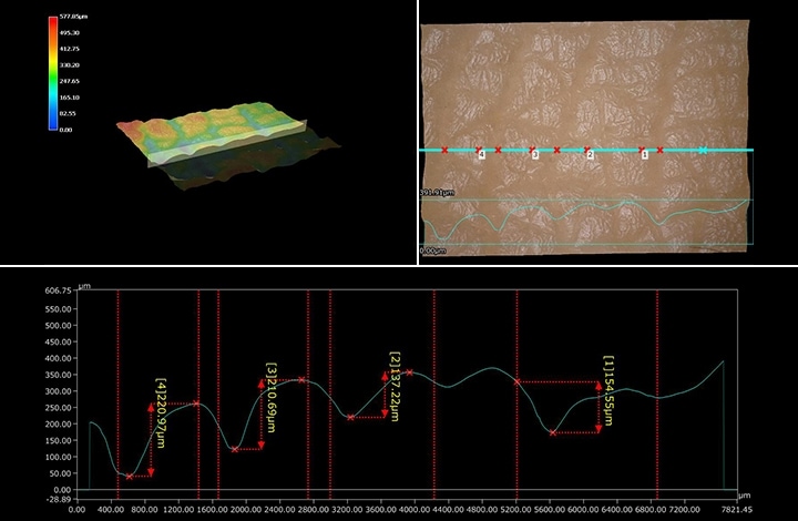 皮肤表面的三维形状与3D轮廓