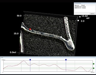 生物可降解性扩张导管支架的3D形状、轮廓测量